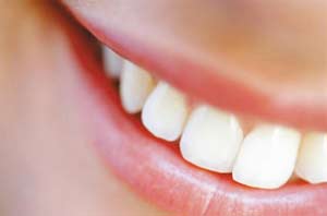 По-перше, стоматологи користуються практично однаковими отбеливающими гелями, що пояснюється невеликою кількістю виробників на ринку